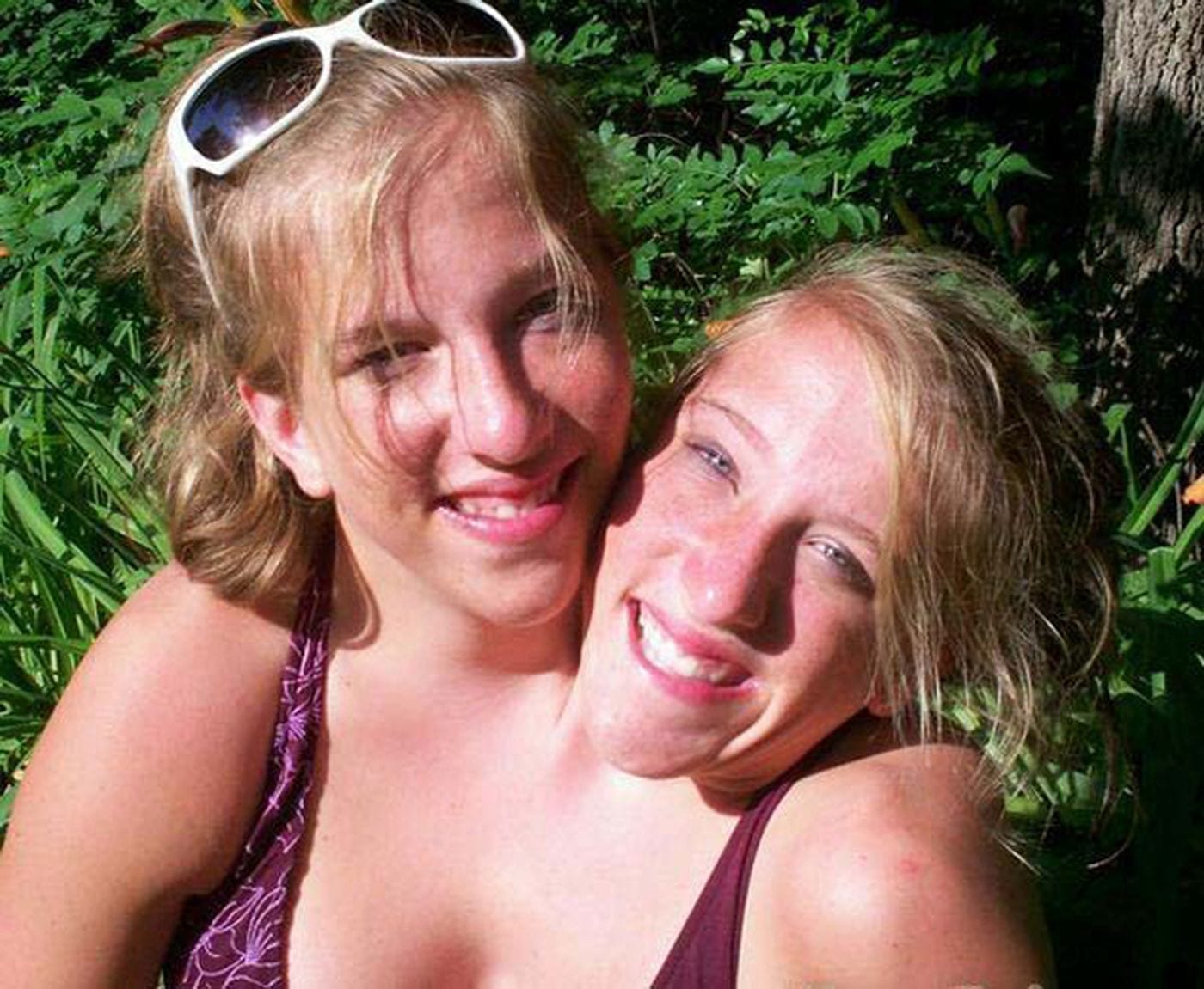 Abby And Brittany Hensel British Most Famous Conjoined Twins Foreign Policy