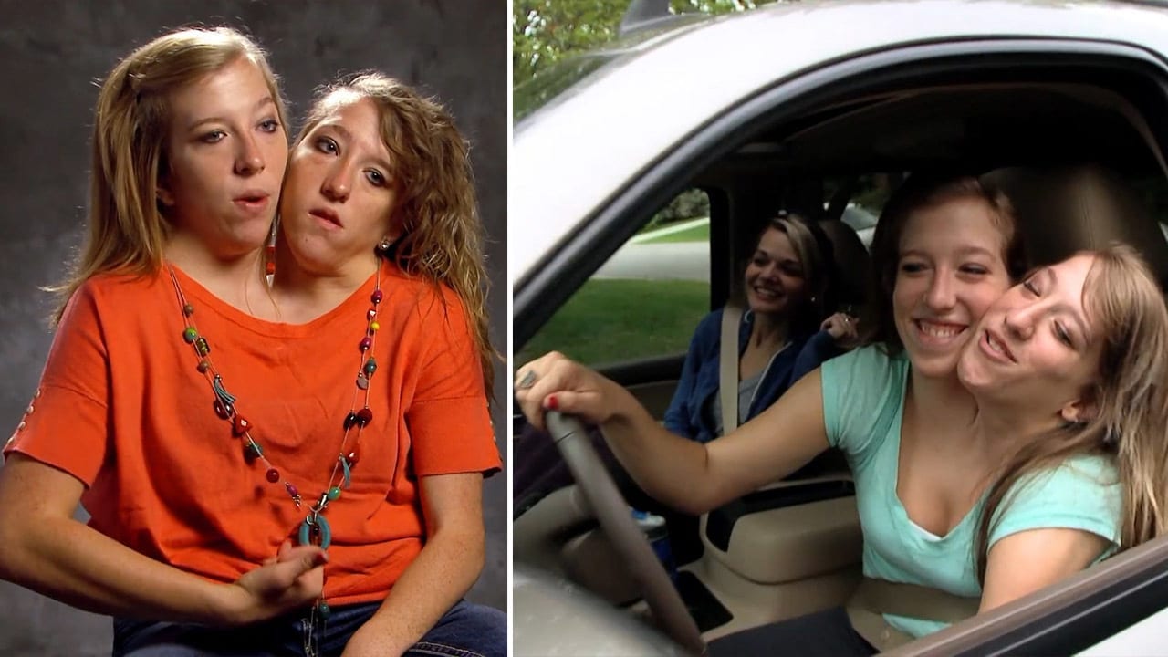Abby And Brittany Hensel, British Most Famous Conjoined Twins - Foreign ...