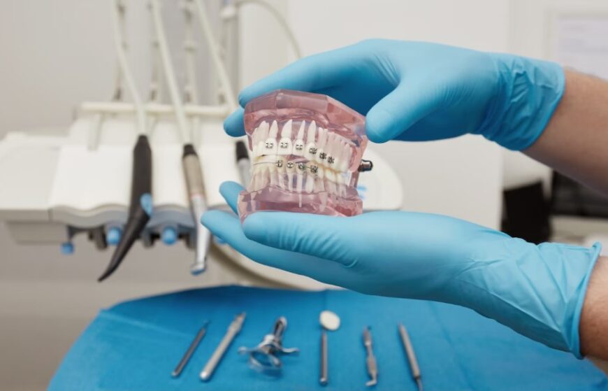 Orthodontic Treatment